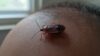 bed bugs avoid hair