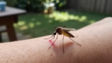 How to Treat a Mosquito Bite