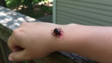 How to Tell if a Tick Is Attached